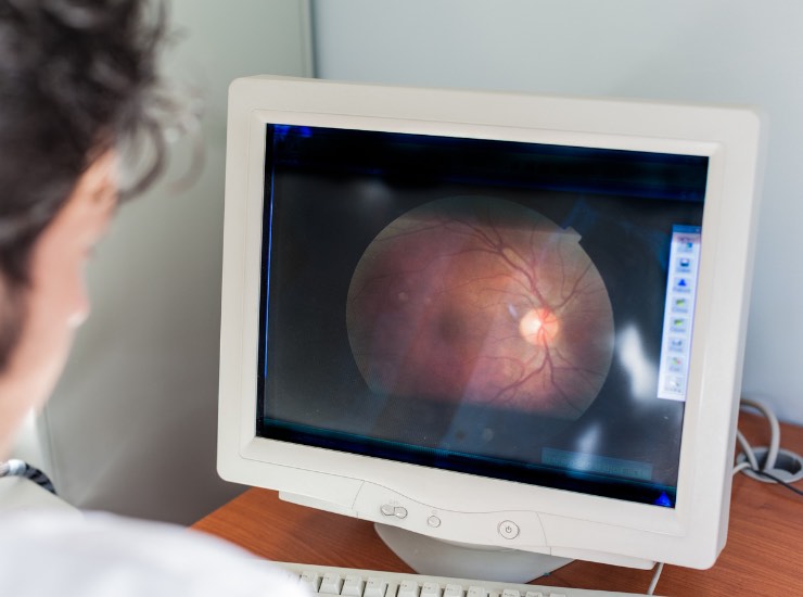 medico analizza una retina a computer