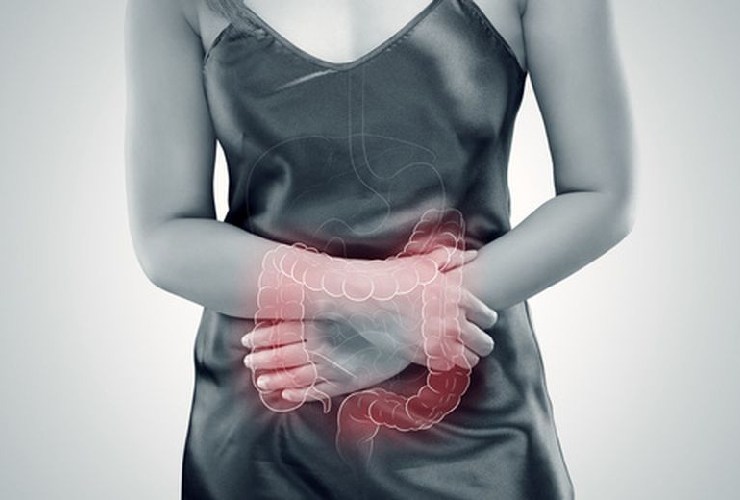 Sindrome del colon irritabile: sintomatologia