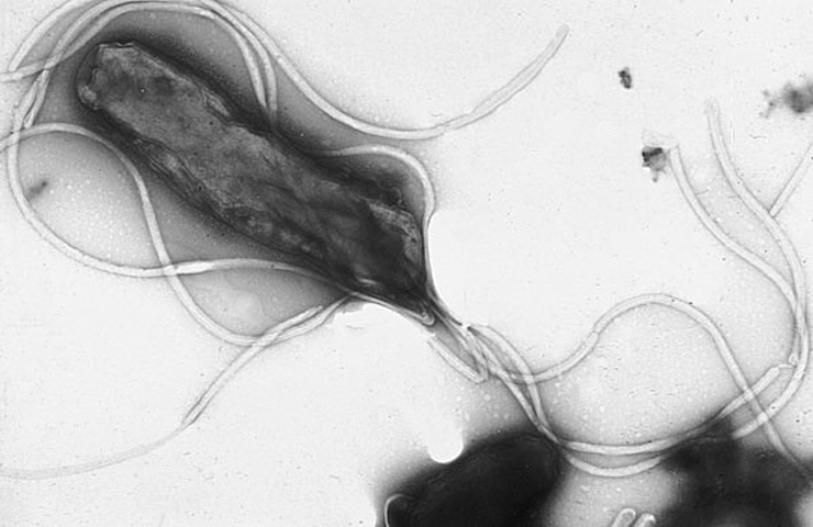 Helicobacter pylori, cos'è, che sintomi causa e come si cura