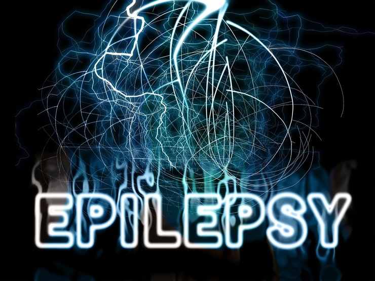 Epilessia